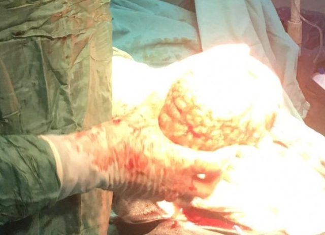 8 aylık hamile sandılar ama... Doktor 'ilk kez karşılaştım' dedi
