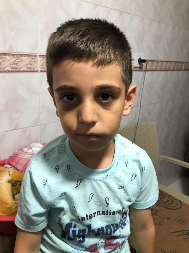 Babasının dövdüğü Mertcan, yaşam savaşını kaybetti