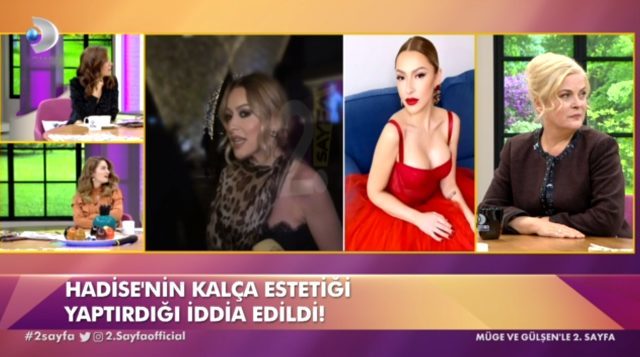 hadise-kim-kardashian-kalcasina-sahip-olmak-icin-12757034_9697_m