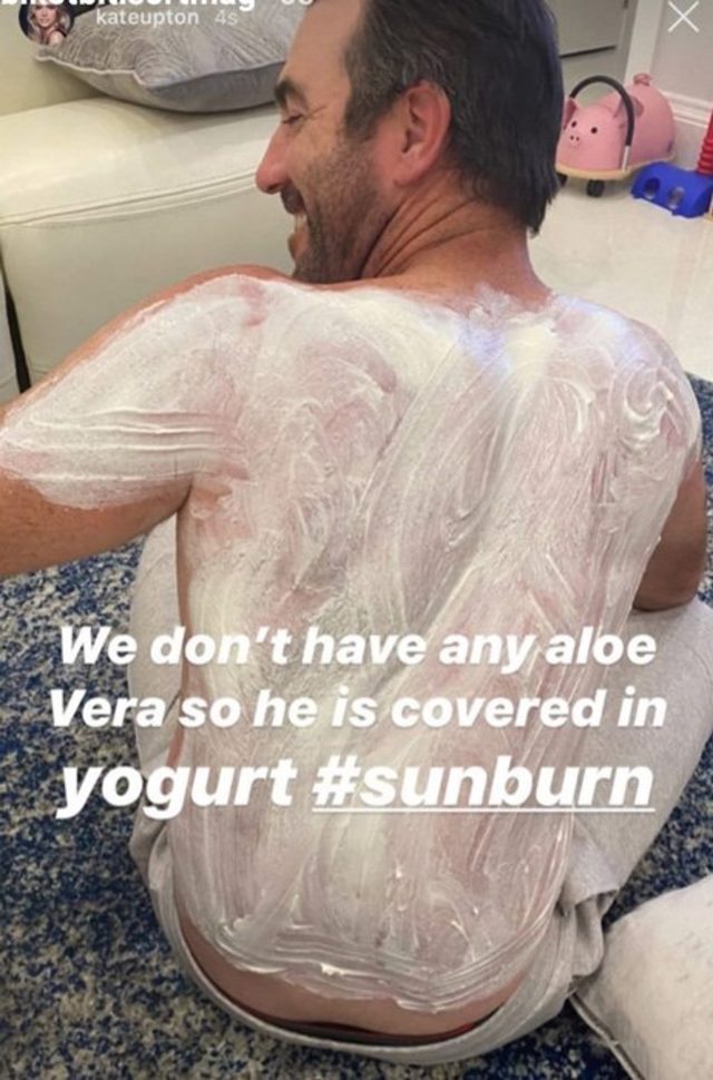 Gunes Yanigi Nasil Gecer Deniz Sonrasi Yaniklar Icin Kolay Cozumler Guzellik Haberleri