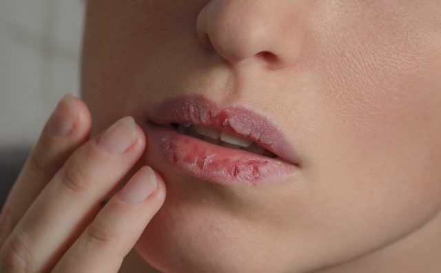 Canlı dudaklar için ballı peeling Canlı dudaklar için ballı peeling