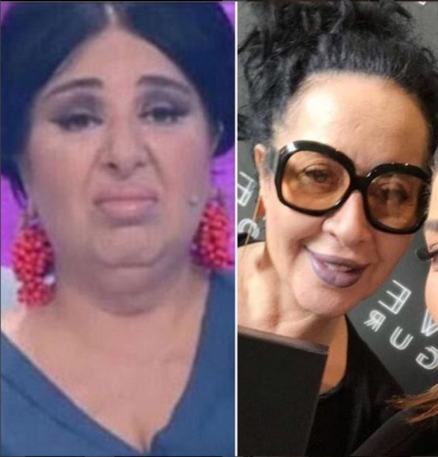 Nur Yerlitaş�ın son hali herkesi şoke ediyor!
