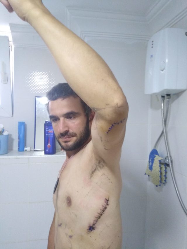 Kırmızı ışıkta, eşinin boşandığı kişinin baltalı bıçaklı saldırısına uğradı