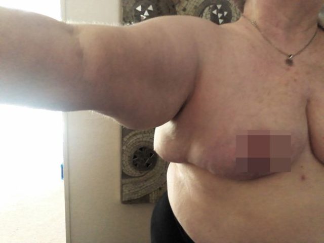 0_PAY-PA-Real-Life-Ferrell-Johnson-Botched-surgery (2)