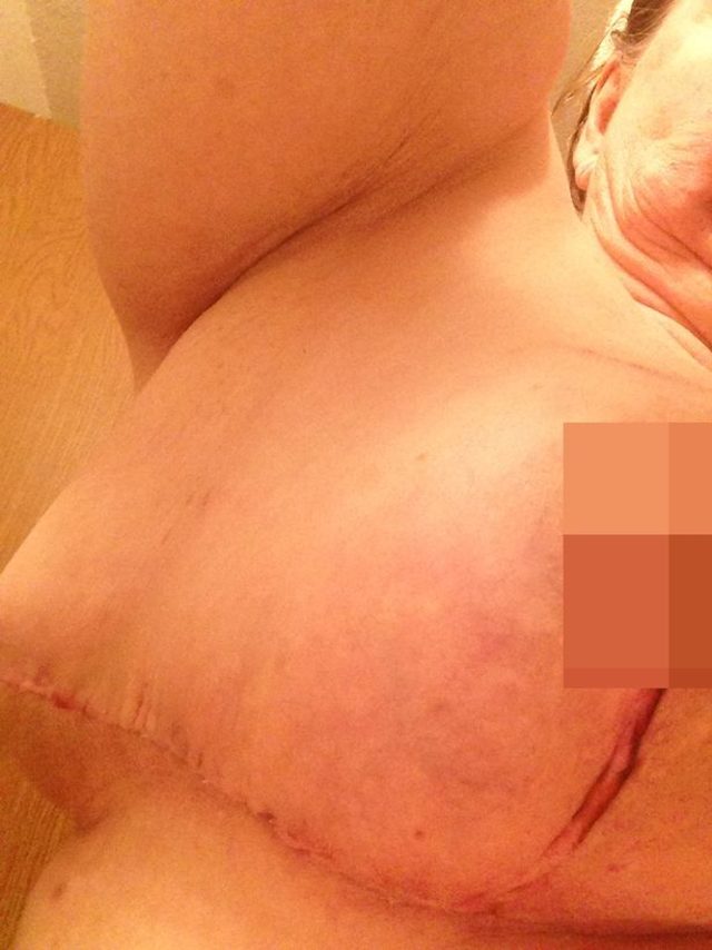 0_PAY-PA-Real-Life-Ferrell-Johnson-Botched-surgery (1)